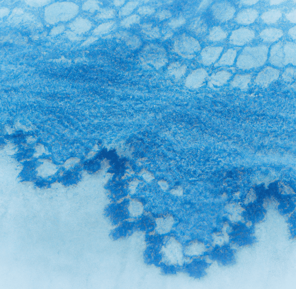 a piece of blue lace fabric with color fading